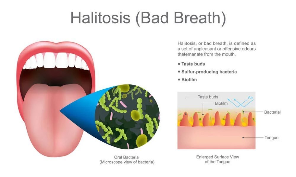 12 Home remedies to get rid of bad breath!