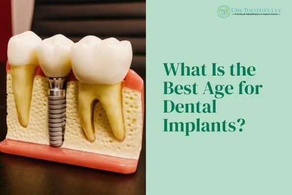What Is the Best Age for Dental Implants? Eligibility, Benefits & Expert Advice