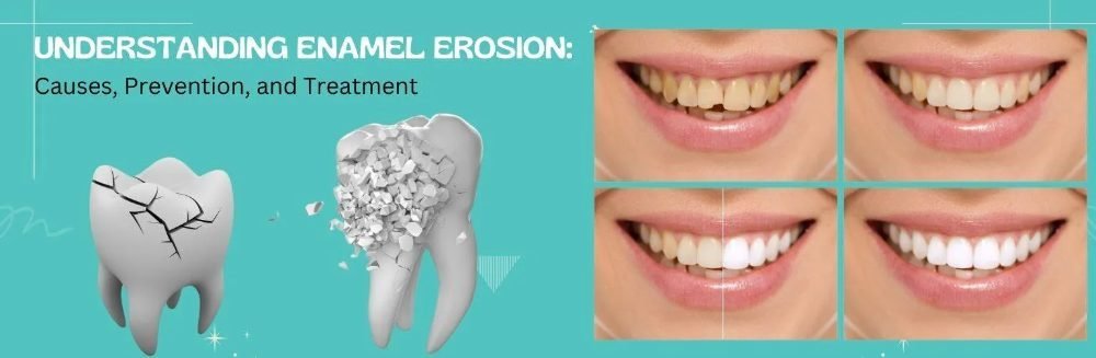 Tooth Enamel Corrosion and Necessary Treatment
