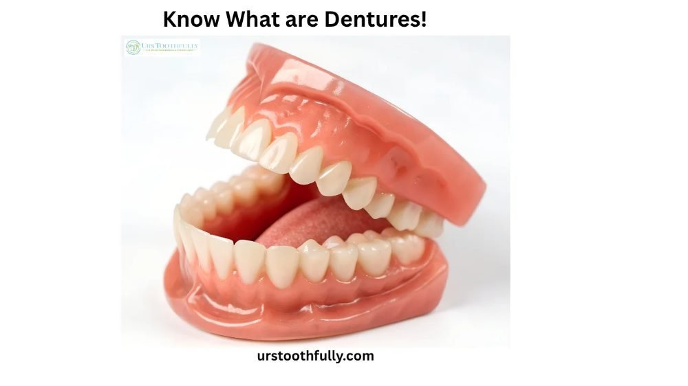 Know What are Dentures: 5 Types, Treatment & Benefits Explained