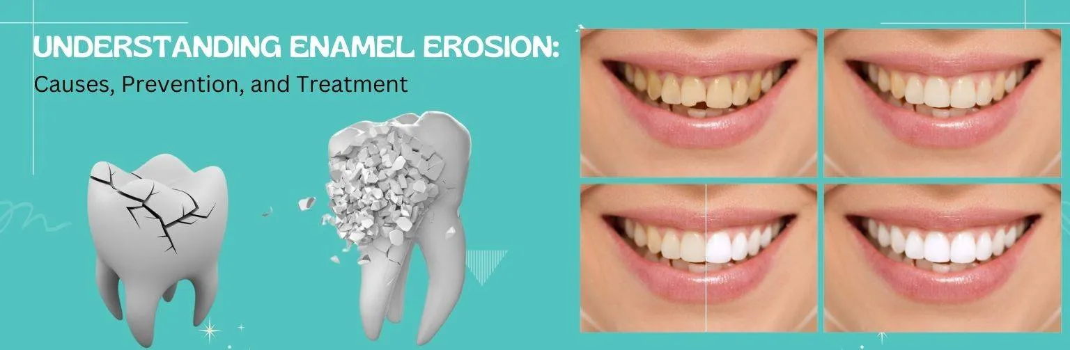 Understanding-Tooth Enamel-Erosion-Causes-Prevention-and-Treatment