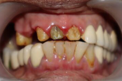 F-Before-2-scaled-e1752326293240
