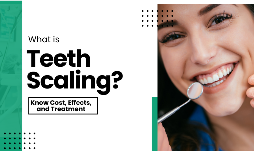 What is teeth scaling Cost, Effects, and Treatment