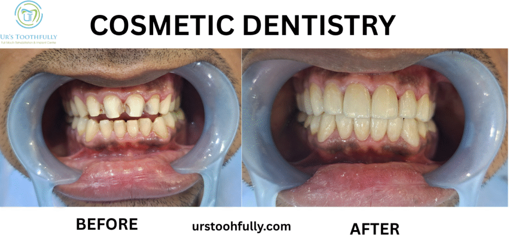 Cosmetic Dentistry in Kolkata - Before & After Patient Result
