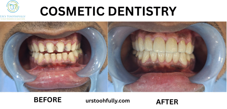 Cosmetic Dentistry in Kolkata - Before & After Patient Result