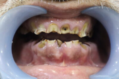 Before-scaled-e1752326234392-1.jpg