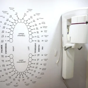 cbct scan machine cbct scan machine